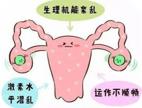驚呆！長期熬夜導(dǎo)致月經(jīng)消失，確診卵巢早衰